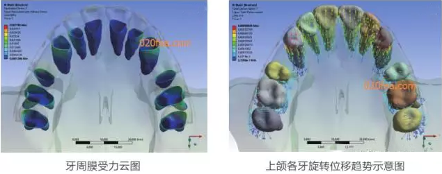 有限元分析法在結(jié)構(gòu)、醫(yī)學(xué)、流體與熱及電場(chǎng)的分析與應(yīng)用