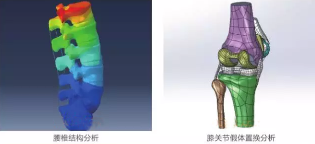 有限元分析法在結(jié)構(gòu)、醫(yī)學(xué)、流體與熱及電場(chǎng)的分析與應(yīng)用